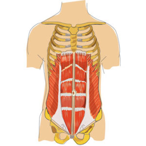 muskelkorsett-rectusdiastase